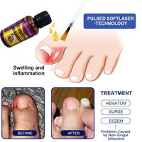 NAILGLOW Bee Venom Nail Serum (Buy 1 Get 1 FREE)